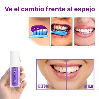 Destello Blanco V34 - Compromiso con la salud de tu boca.